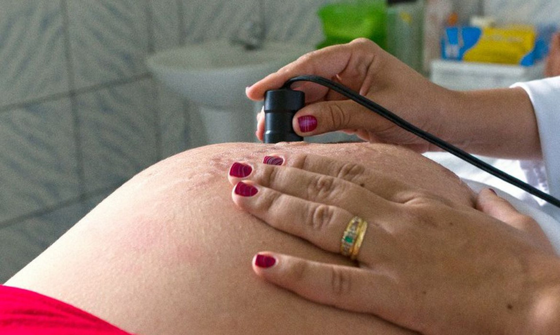 Número de óbitos de grávidas em 2021 já ultrapassa todo ano de 2020