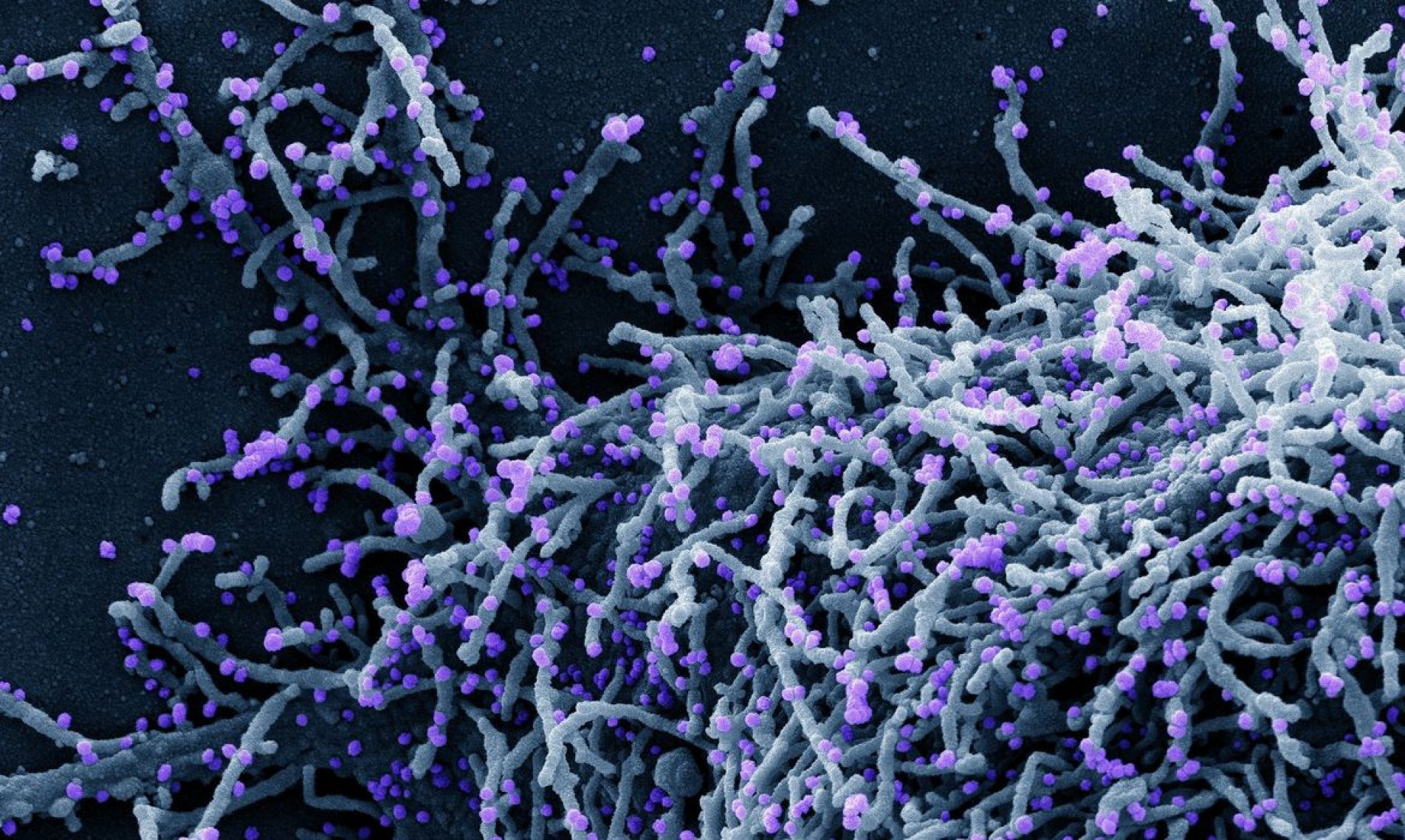 Novo Coronavírus SARS-CoV-2
Micrografia eletrônica de varredura colorida de uma célula infectada com uma cepa variante de partículas do vírus SARS-CoV-2 , isolada de uma amostra de paciente. Imagem capturada no Centro de Pesquisa Integrada (IRF) do NIAID em Fort Detrick, Maryland. Crédito: NIAID