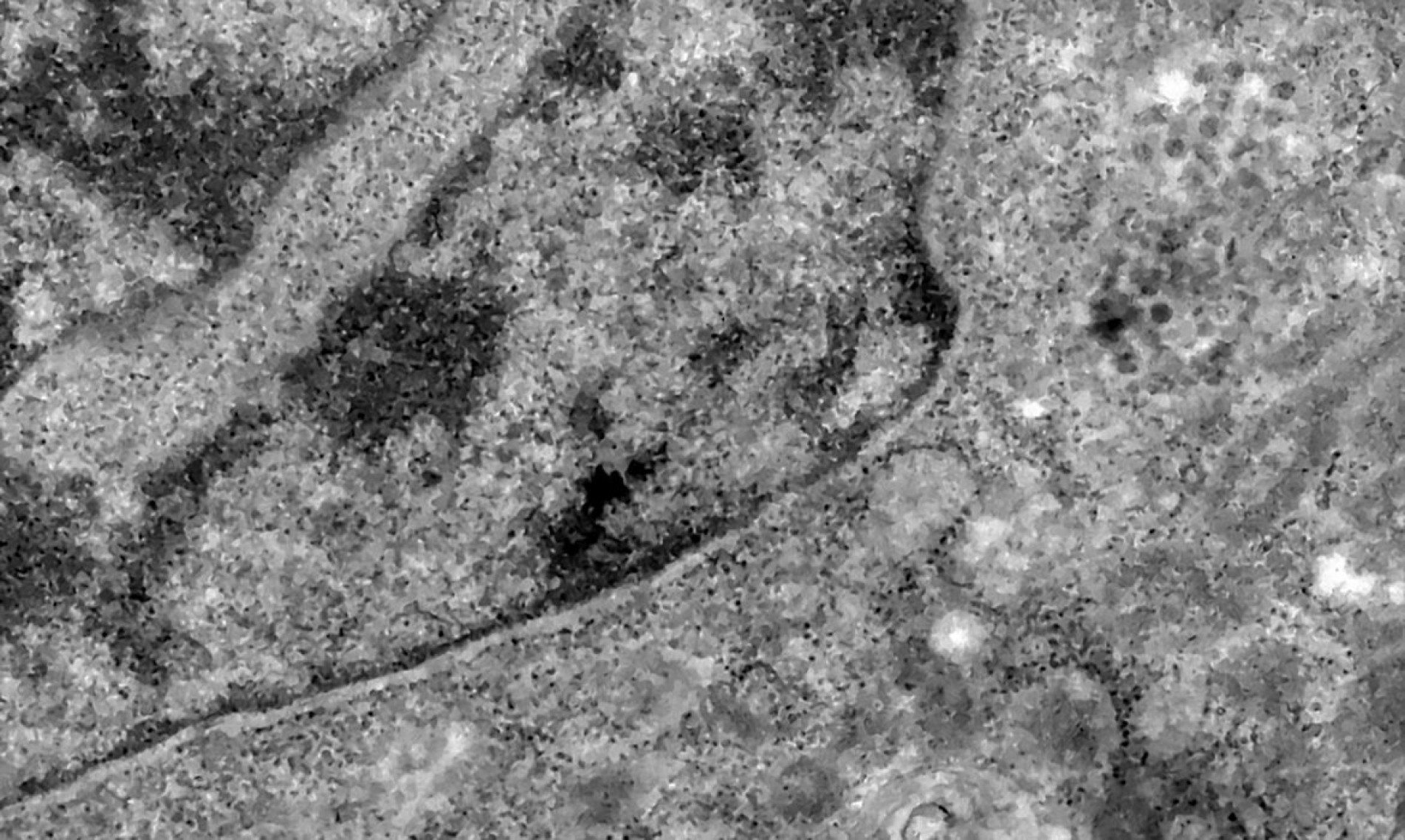 Várias partículas virais de Sars-CoV-2 são observadas no interior da célula após a infecção e a replicação viral. Registro do momento exato em que uma célula é infectada pelo novo coronavírus, obtido durante estudo que investiga a replicação viral do Sars-CoV-2 realizado pelos Laboratório de Morfologia e Morfogênese Viral e Laboratório de Vírus Respiratórios e do Sarampo, Instituto Oswaldo Cruz.