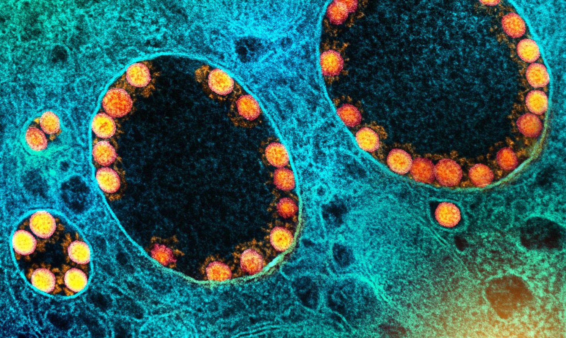 Foi descoberto, na variante Ômicron, que a proteína spike contém mutações já conhecidas, responsáveis por aumentar a transmissibilidade do vírus