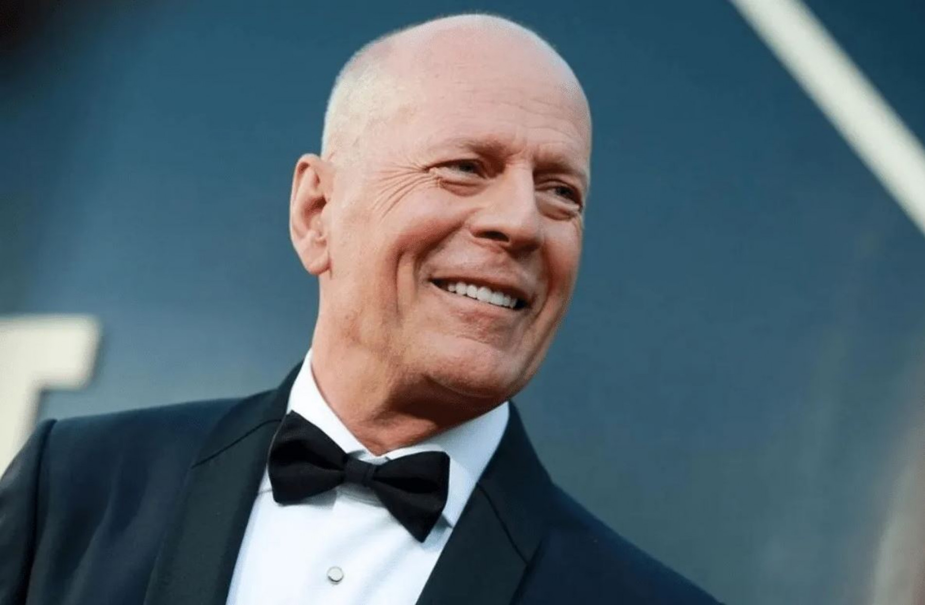 Bruce Willis foi diagnosticado com afasia e se aposentou.