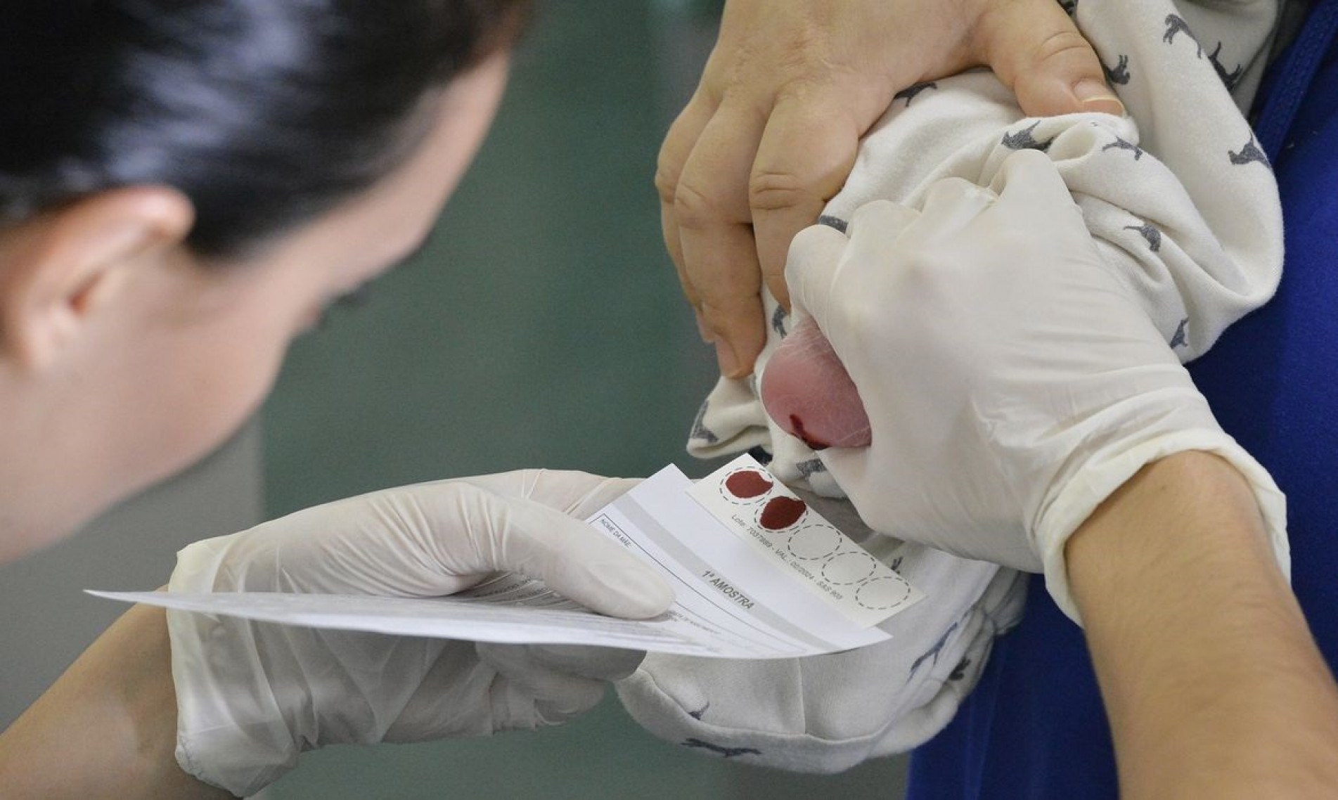  Teste do pezinho no Hospital Regional de Taguatinga (HRT).