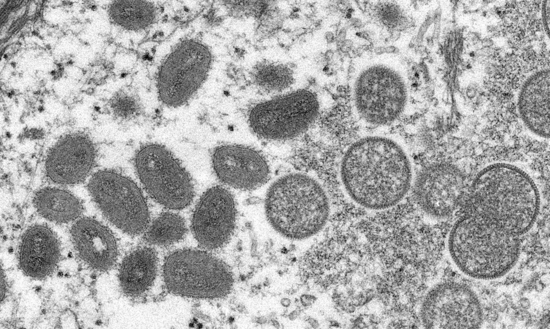 O Brasil tem, até o momento, seis casos confirmados de varíola dos macacos 