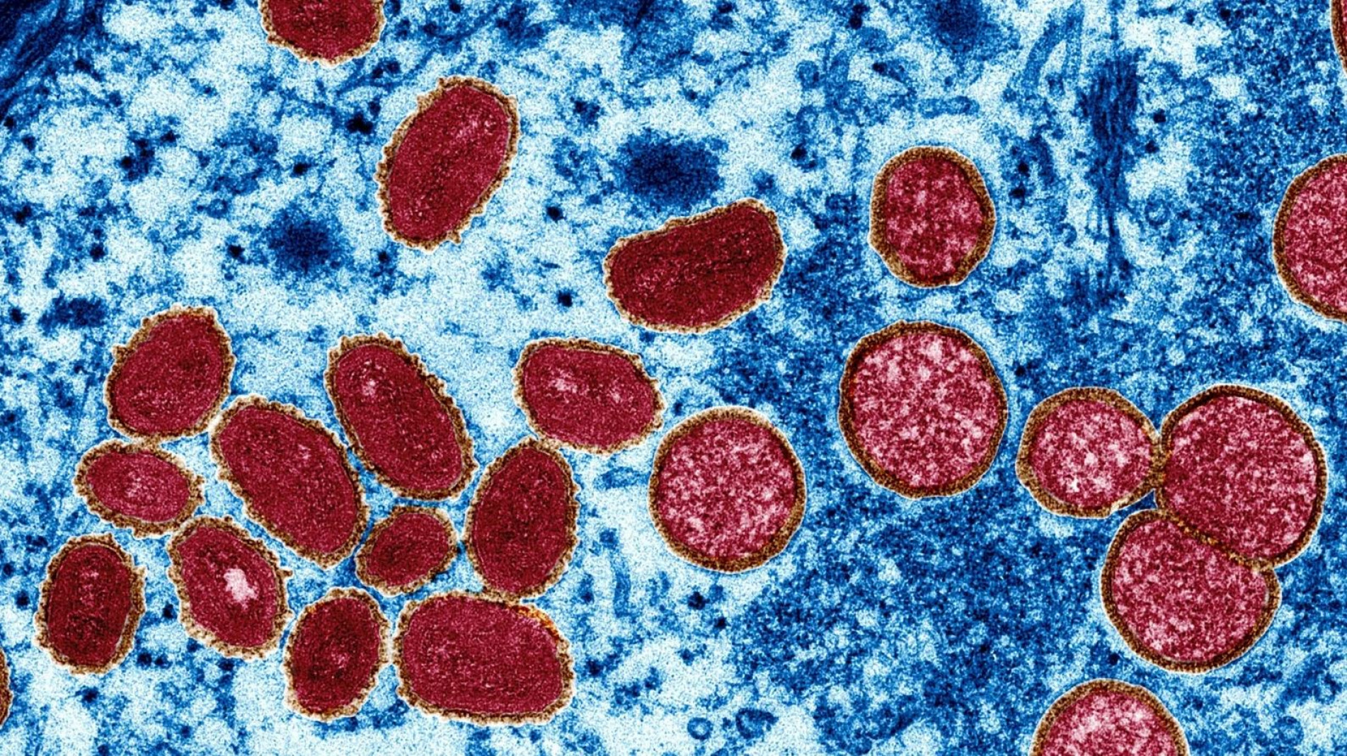 Esta imagem de microscópio eletrônico mostra partículas do vírus da varíola dos macacos coletadas de uma amostra de pele humana durante o surto de 2003. À esquerda estão partículas de vírus maduras e ovais; à direita há vírus imaturos esféricos e arqueados