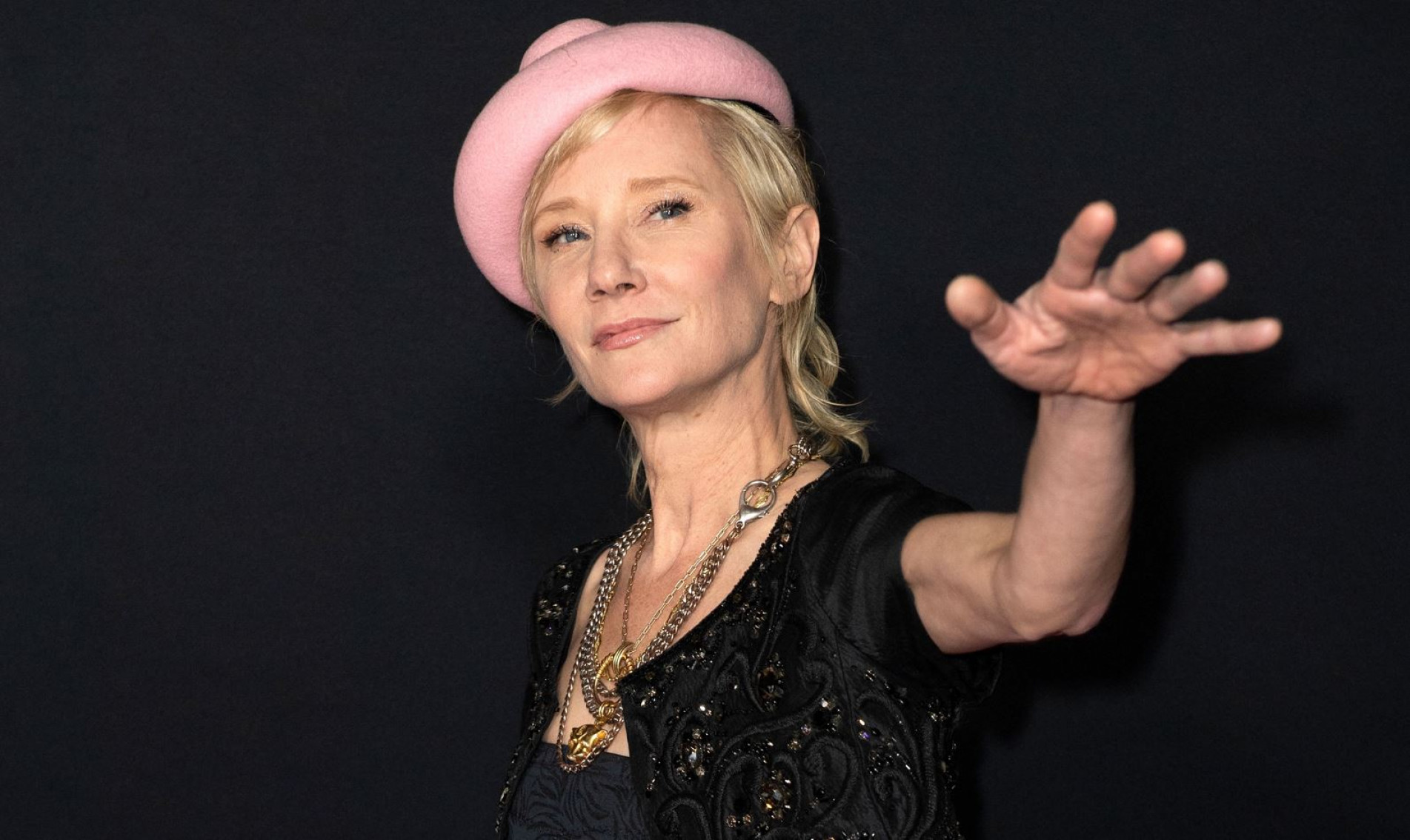 Anne Heche sofreu acidente de carro em Los Angeles