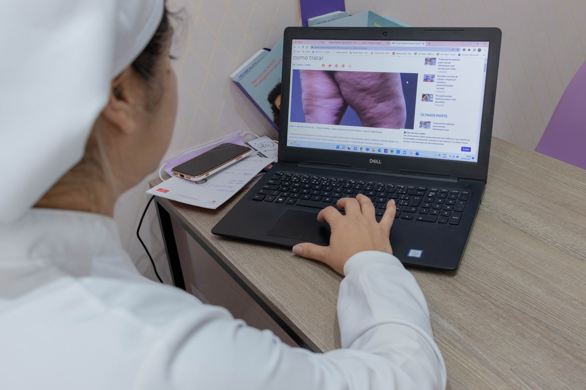 Celulites se manifestam como marcas onduladas ou granulosas em determinadas partes do corpo; uma simples busca online mostra o quanto o assunto é motivo para preocupação de muita gente em todo o mundo