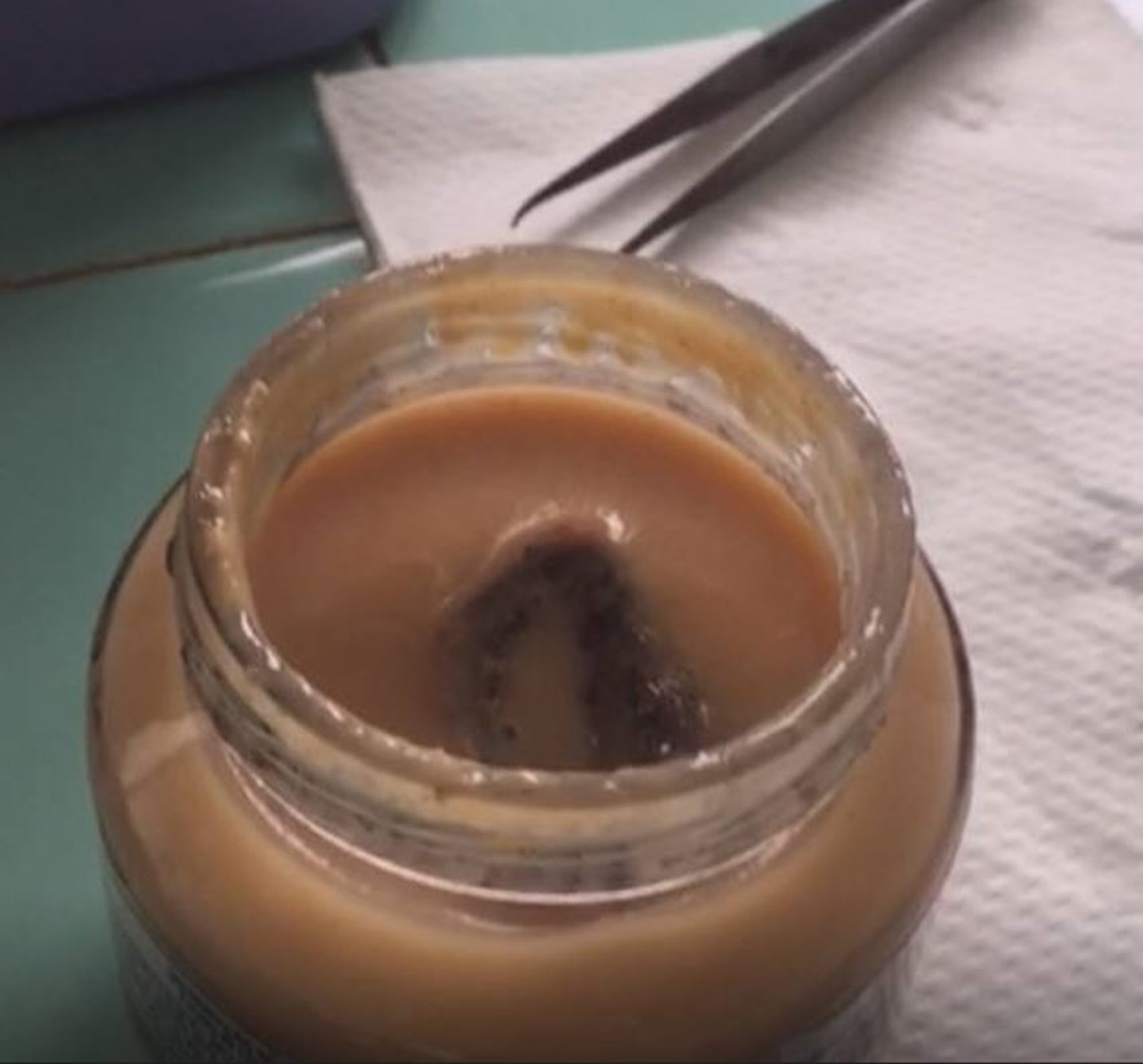 Material é preto, mede cerca de três centímetros e não tem cheiro ruim; Nestlé diz que o problema pode ter sido provocado por 