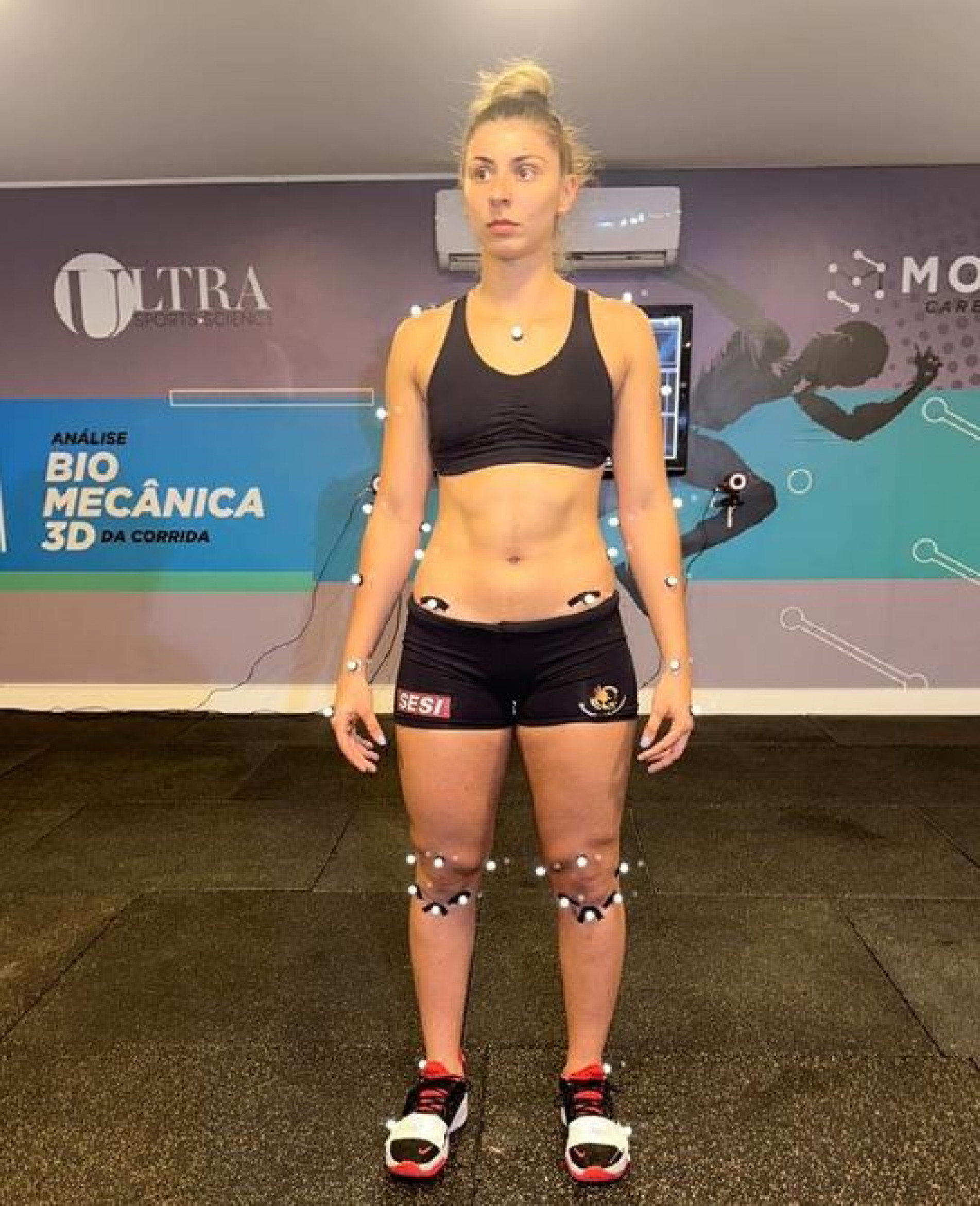 Kau, de 19 anos, passou por cirurgia em 2022