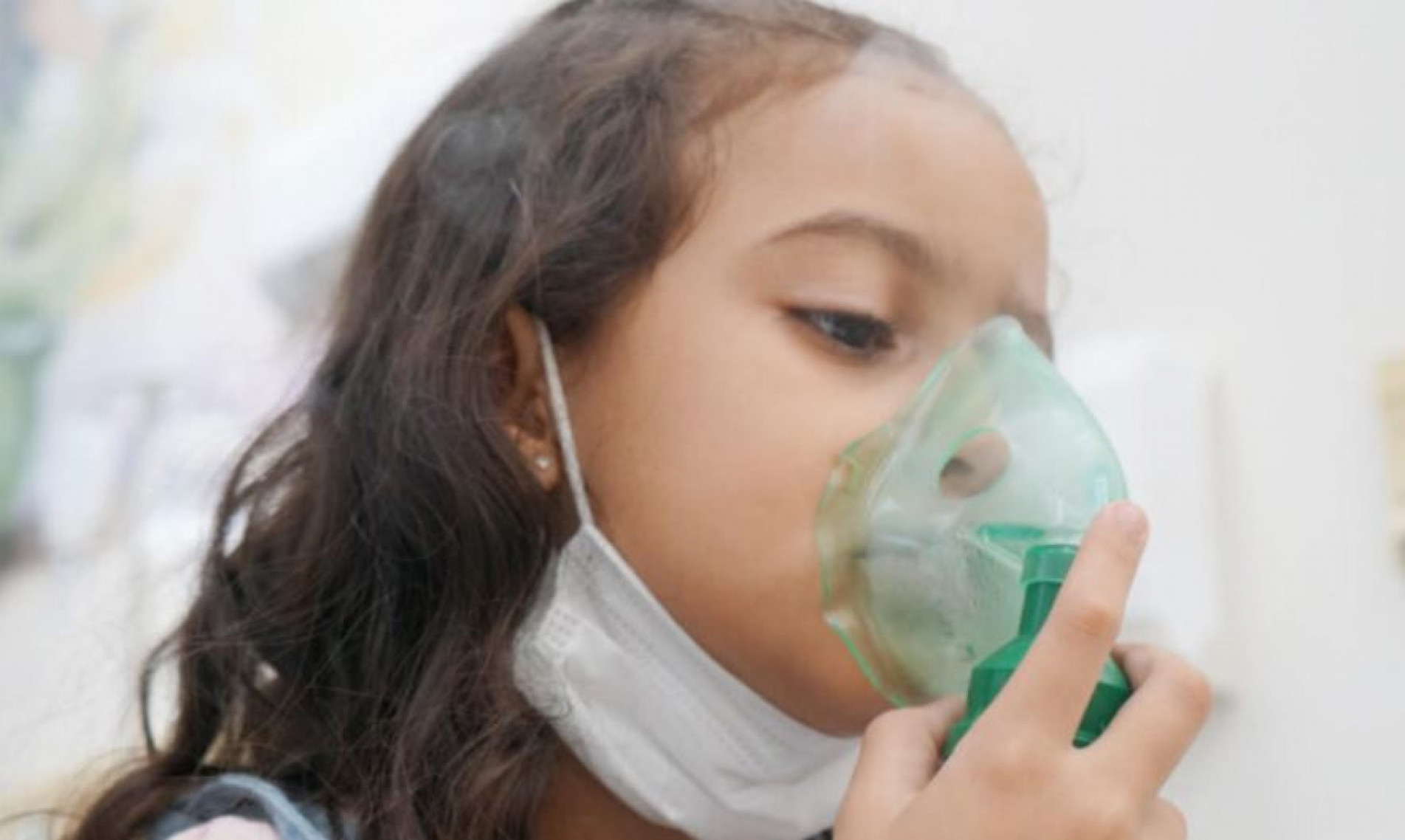 O causador da maioria das infecções é o vírus sincicial respiratório (VSR)