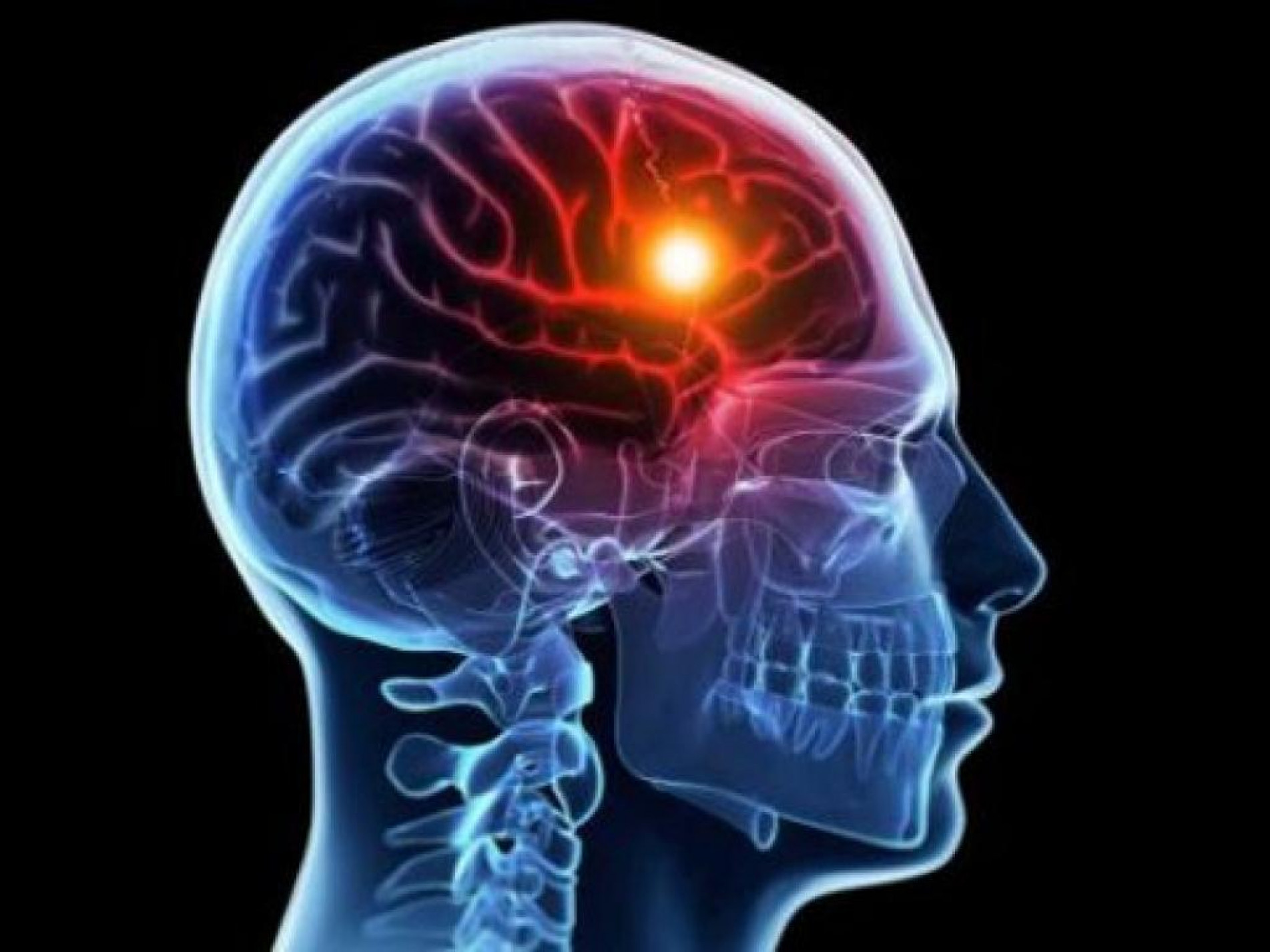 Doença é uma das que mais mata brasileiros