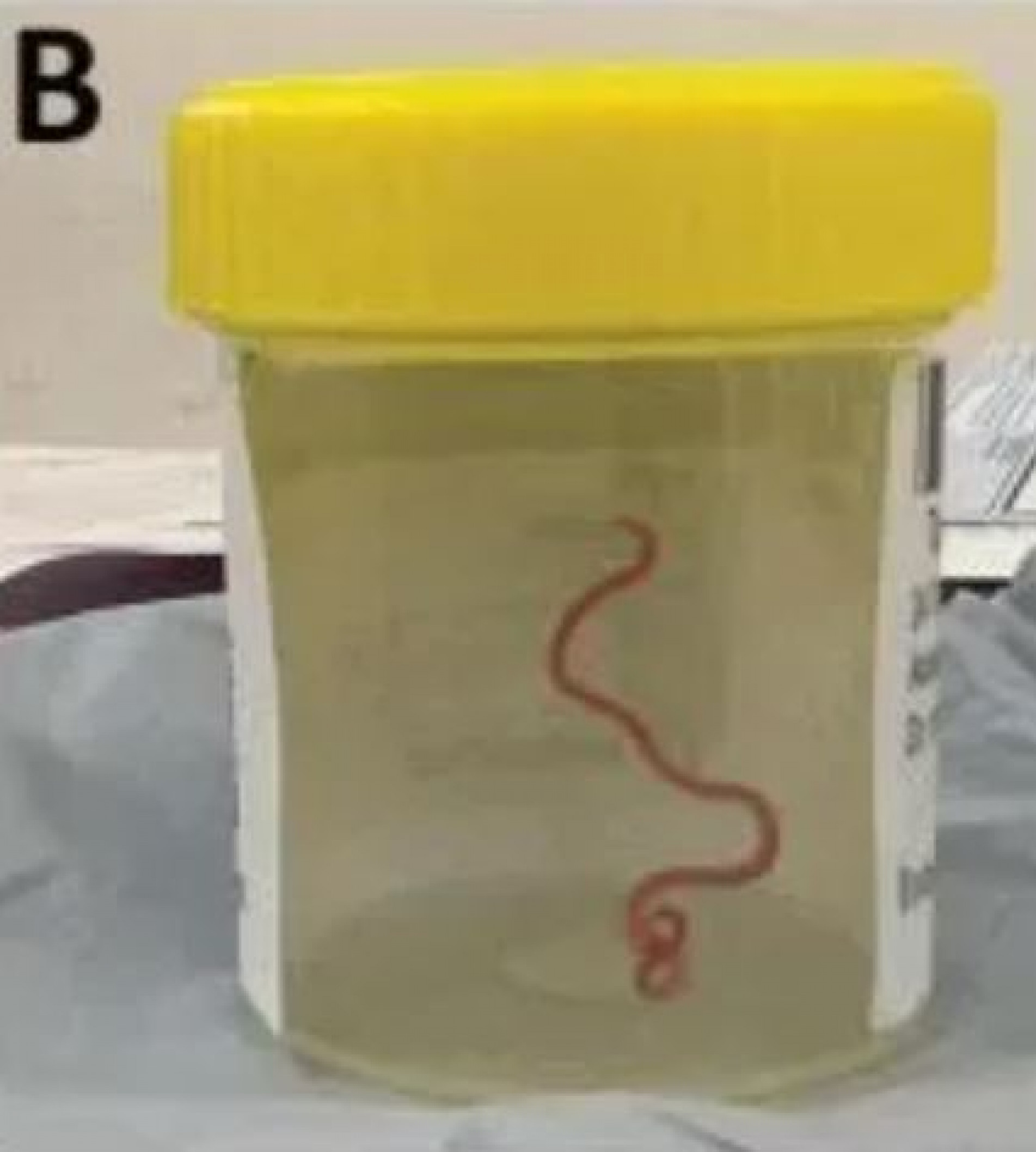 O Ophidascaris Robertsi, de 8 cm, não é conhecido como parasita humano