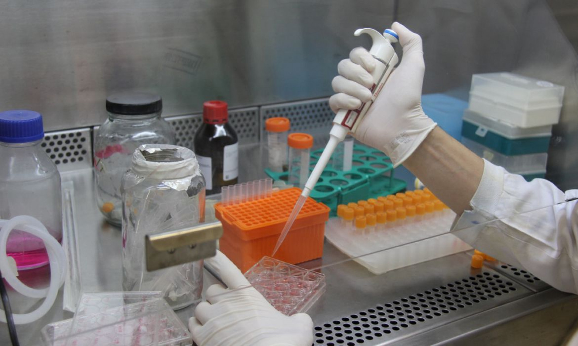 A pesquisa com células CAR-T é considerada mais um avanço no tratamento contra o câncer no sangue 