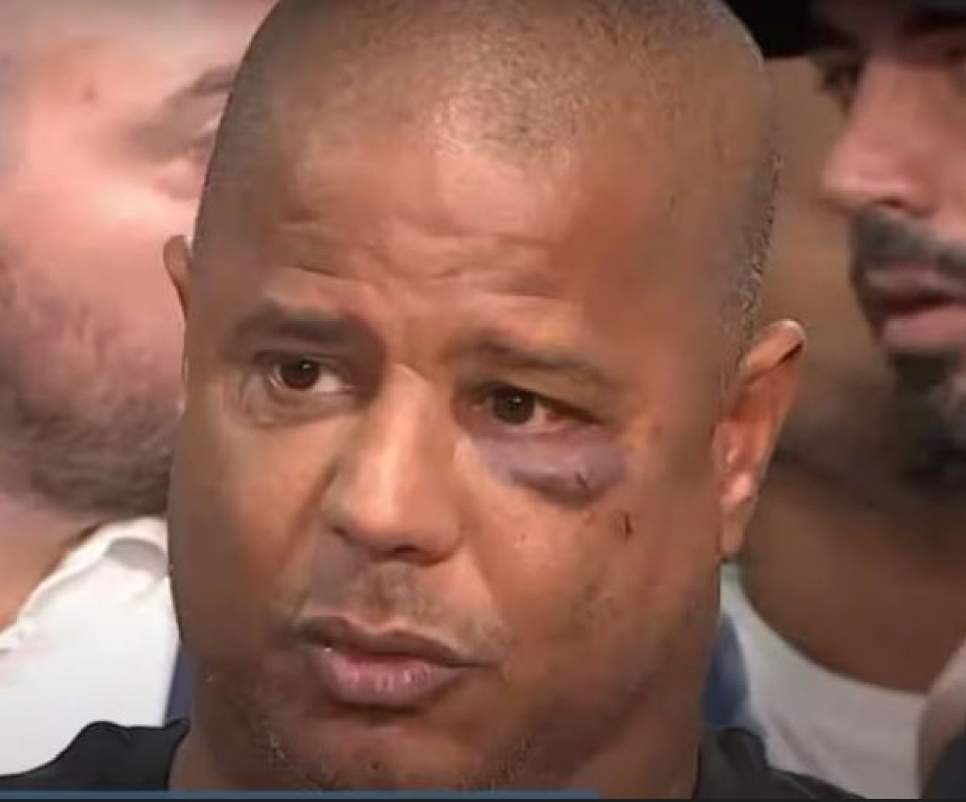 Ex-jogador foi agredido por bandidos
