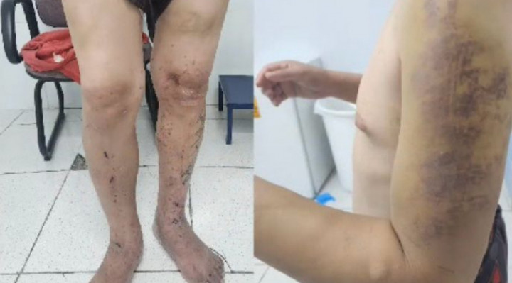 Monitores da clínica de reabilitação são acusados de torturar, agredir e estuprar pacientes  