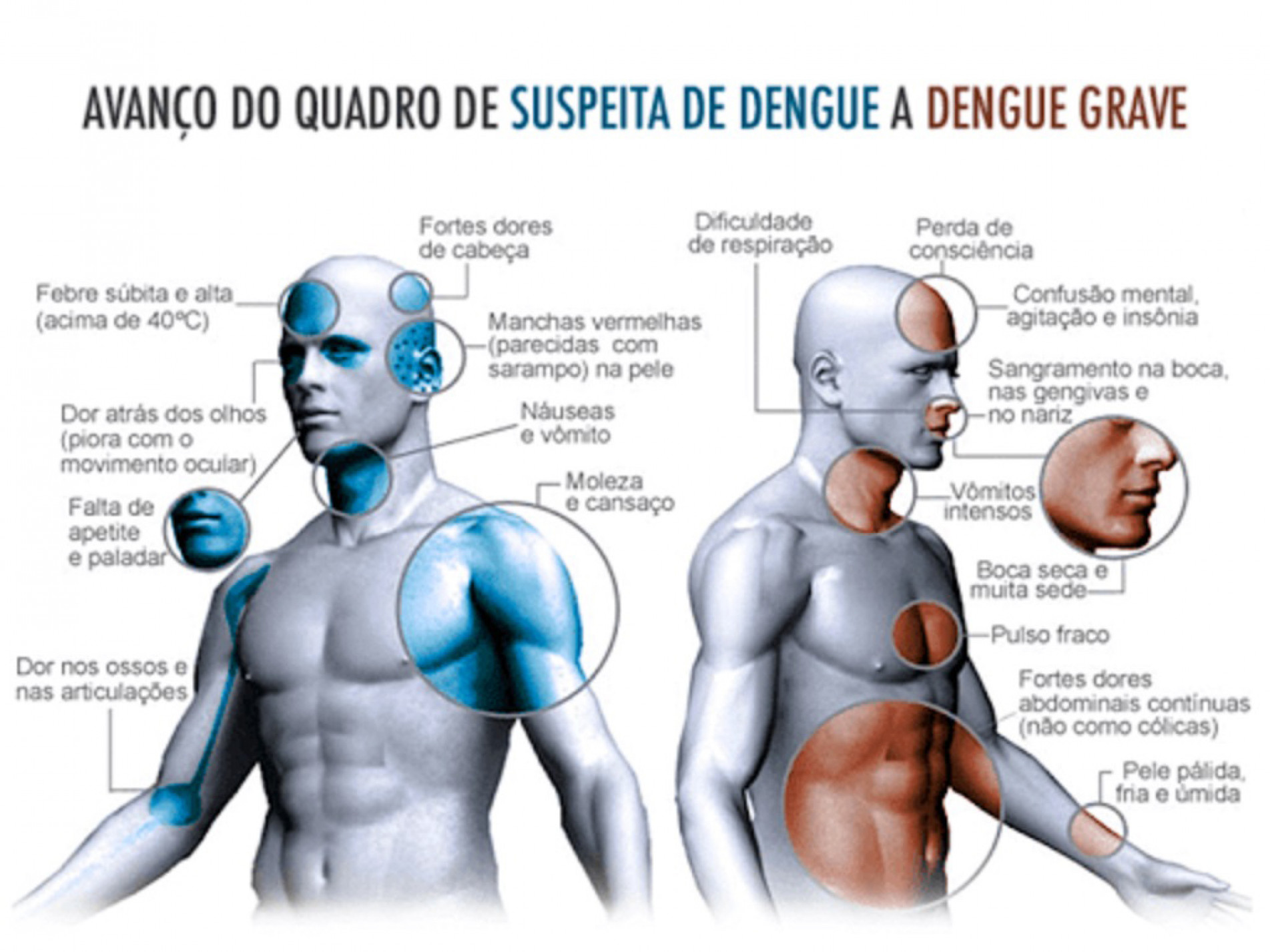Infectologista ressalta que as complicações podem aparecer a partir do terceiro dia
