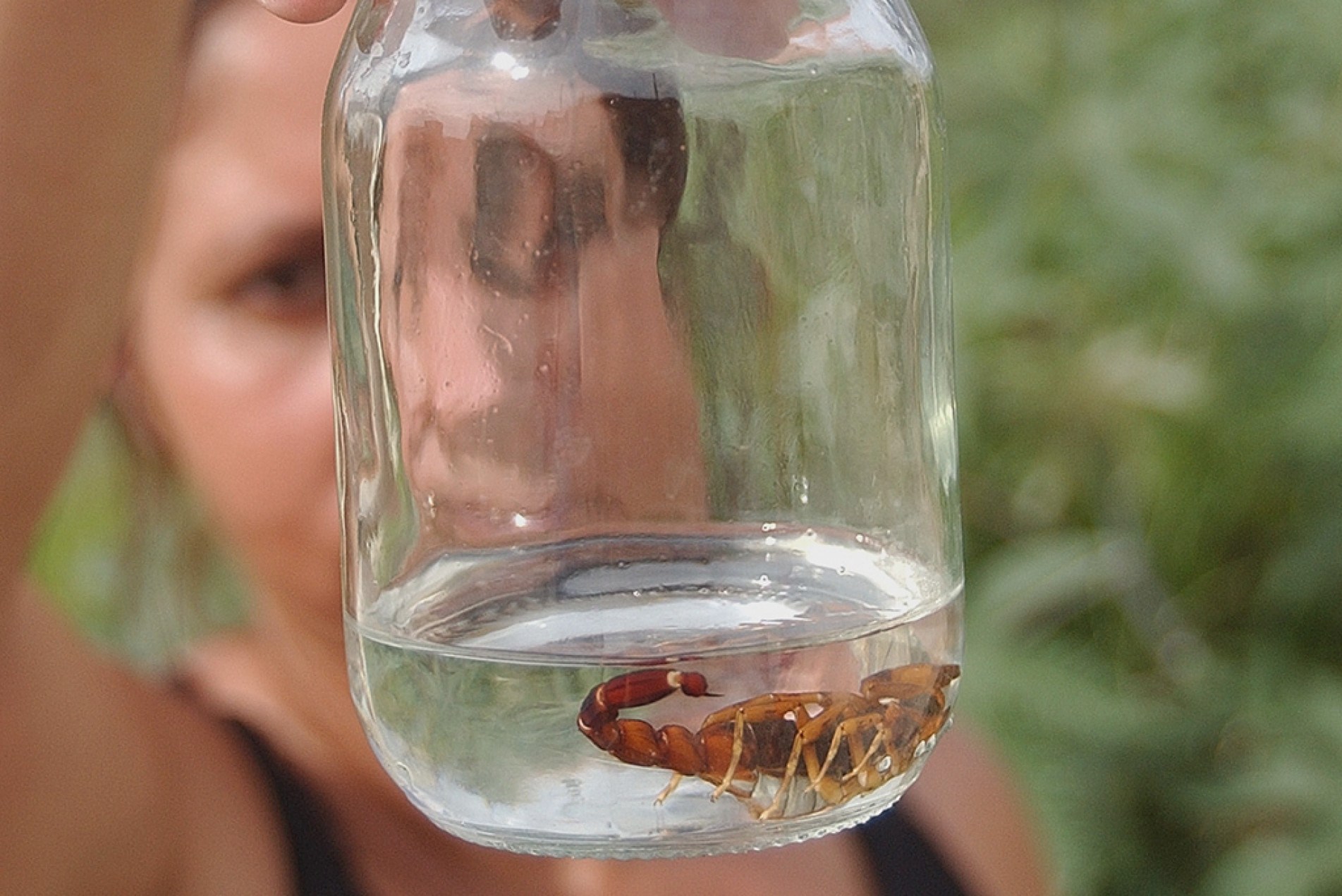 Para evitar complicações, vítimas de picadas de animais peçonhentos, 
inclusive escorpiões, devem receber atendimento médico o mais rápido possível
