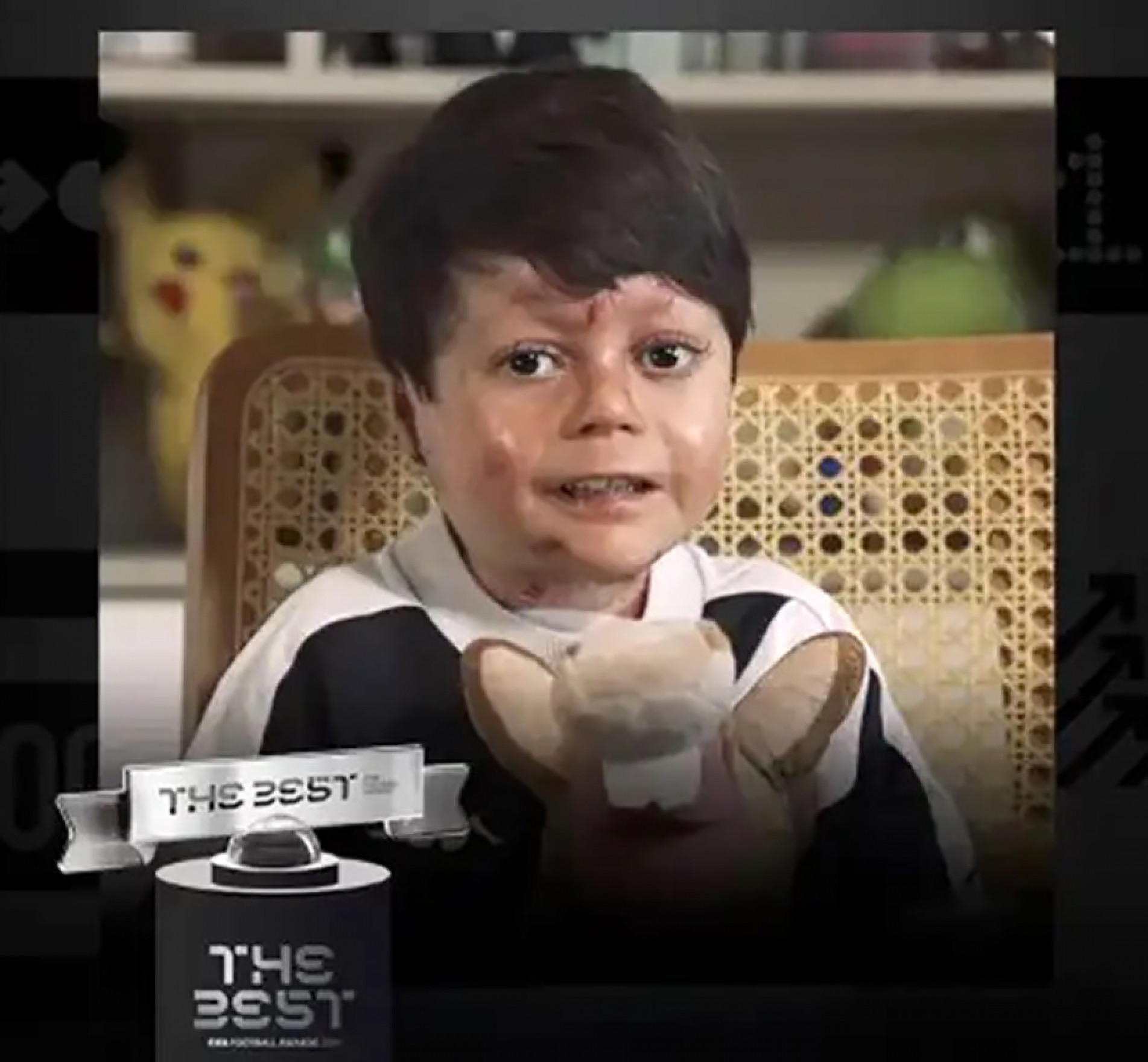 Carioca é portador de doença genética rara
