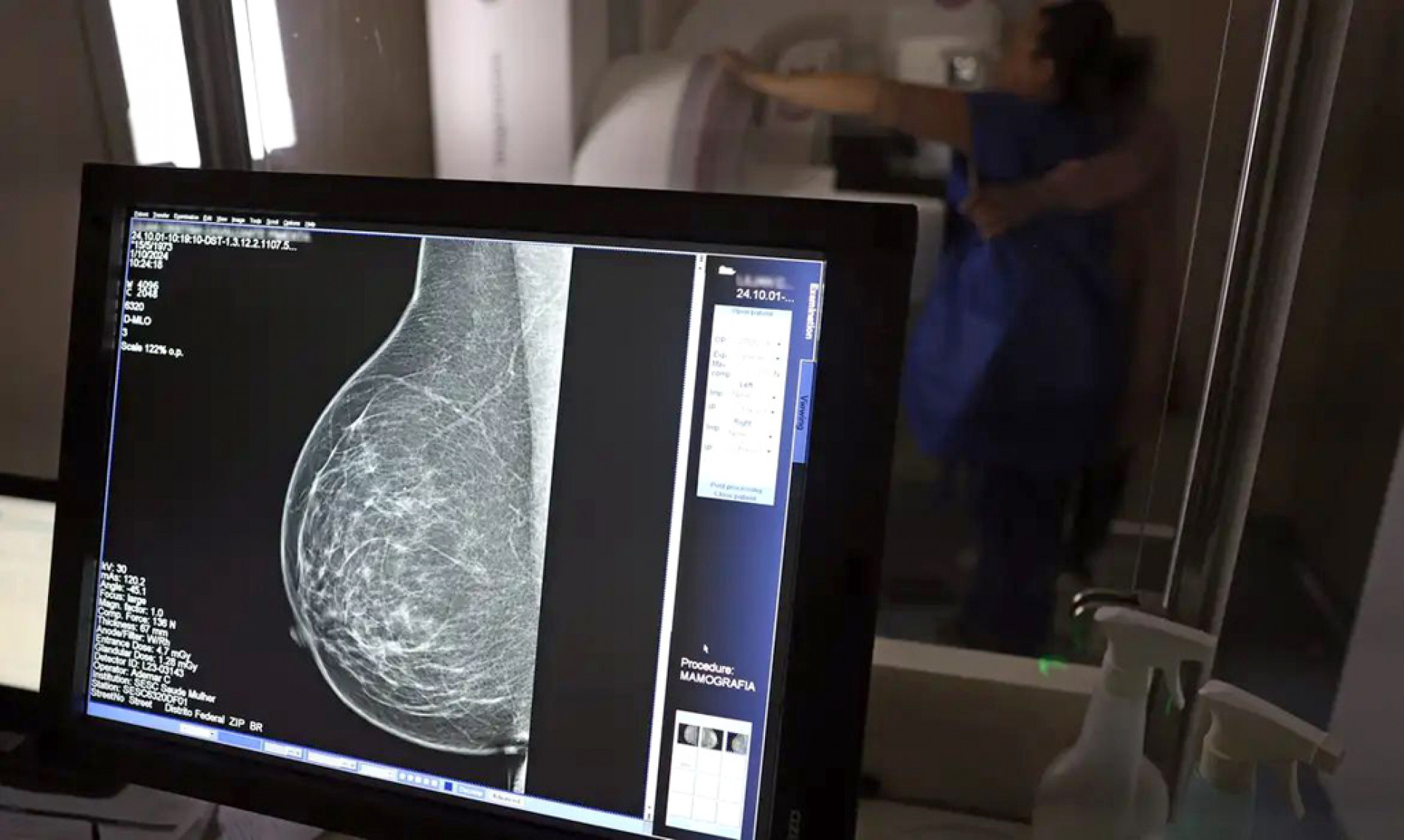 Antes, orientação era a partir dos 50 anos
