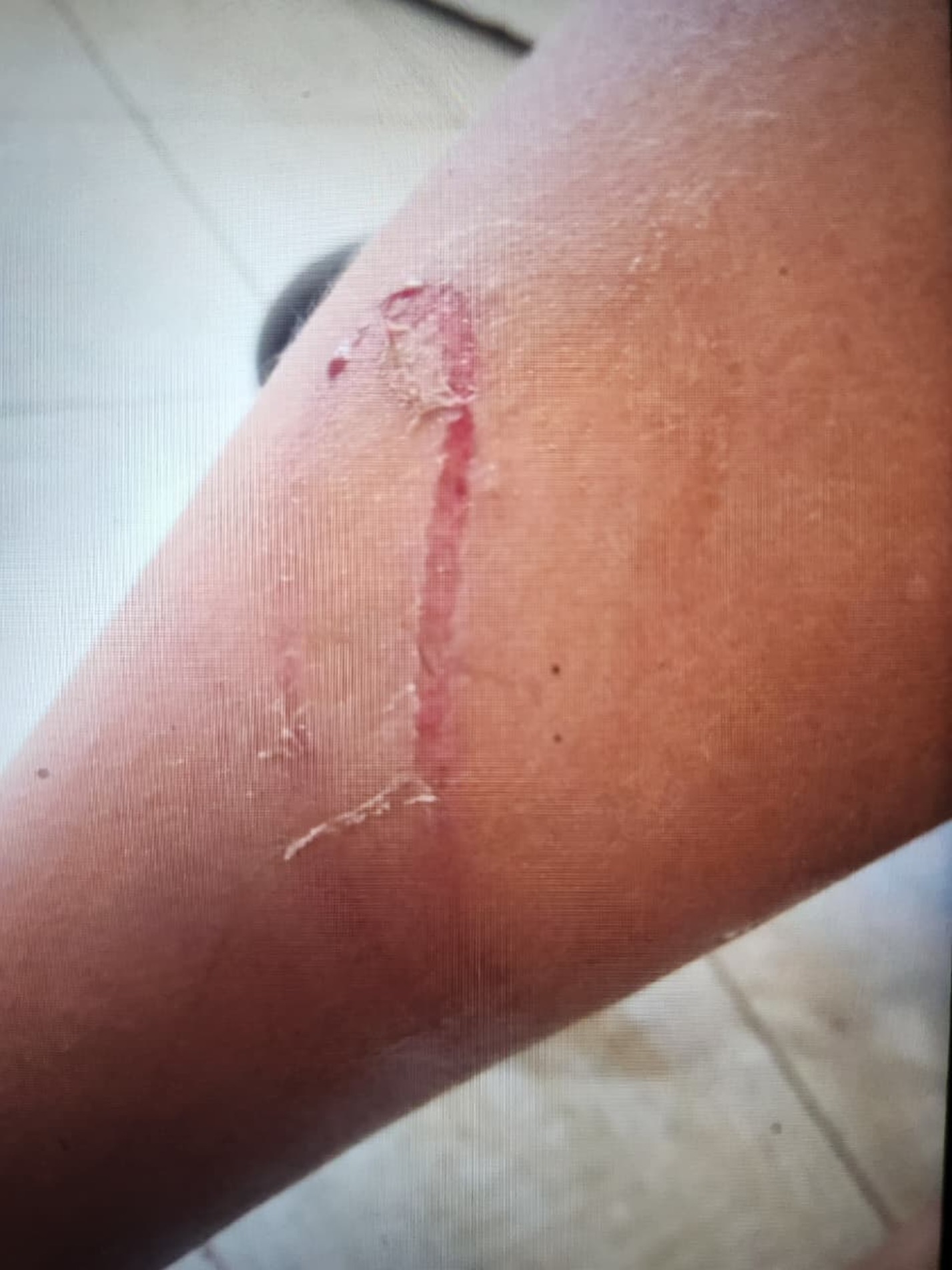 O suspeito foi conduzido à delegacia e confessou a violência, mas disse que não teve intenção de ferir o enteado