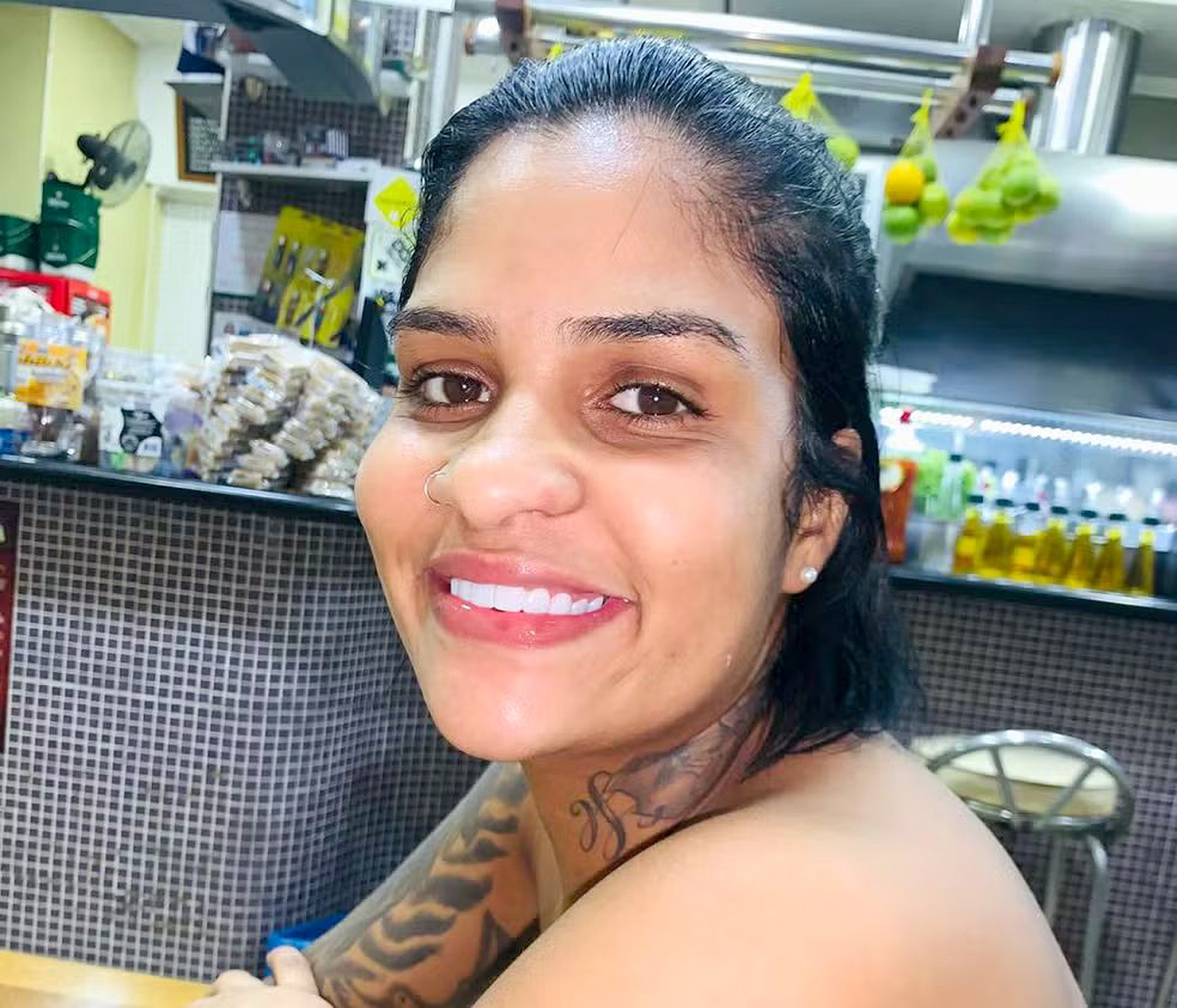 Taynara Santos teve de amputar as duas pernas 