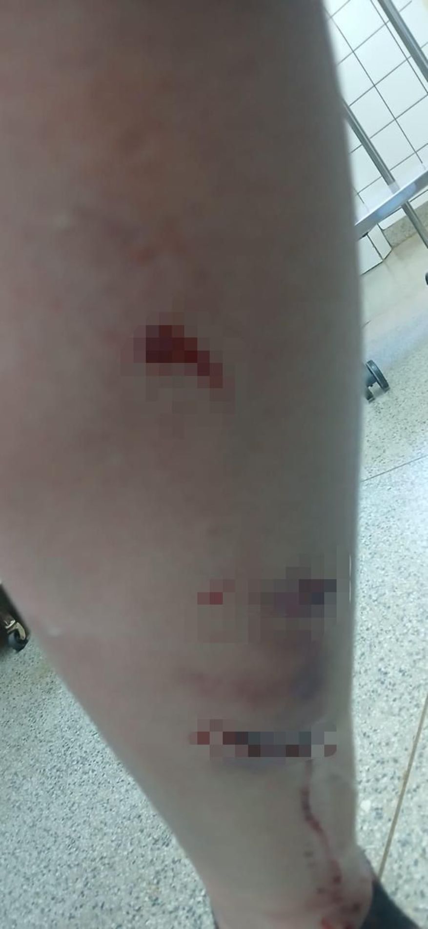 No dia 11 de novembro de 2025, cães do mesmo local já haviam atacado um homem