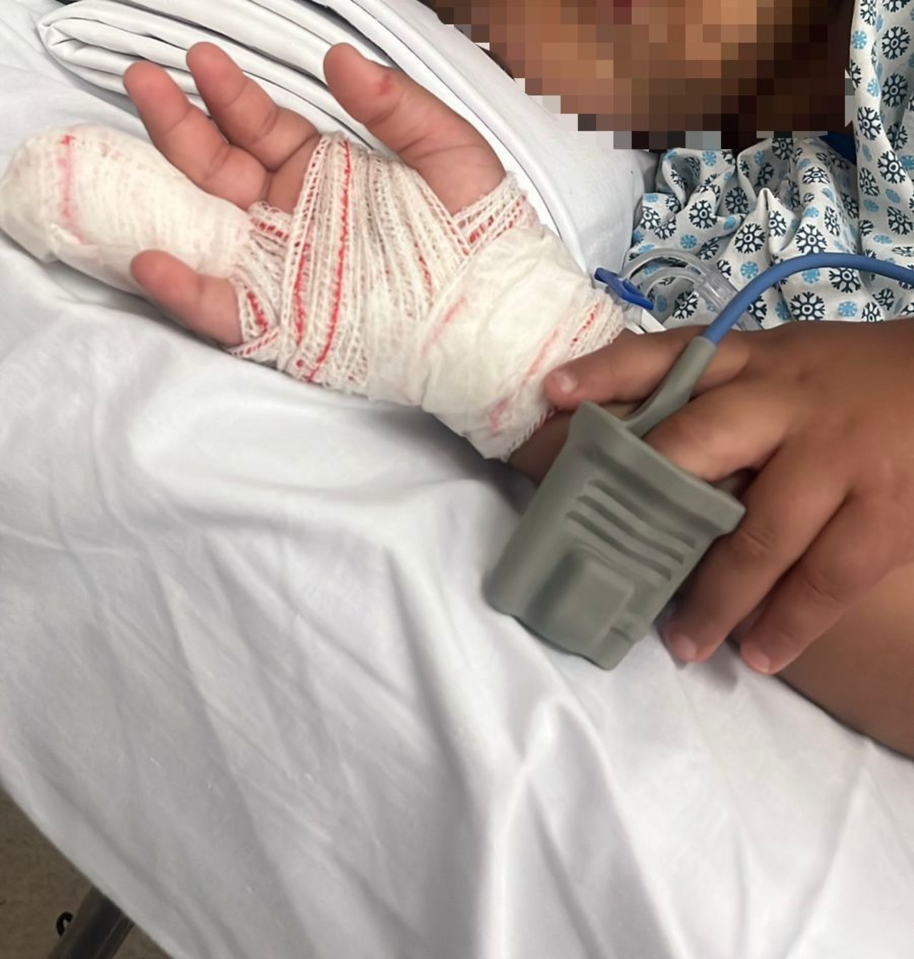 O menino foi levado ao Hospital Regional, onde passou por cirurgia