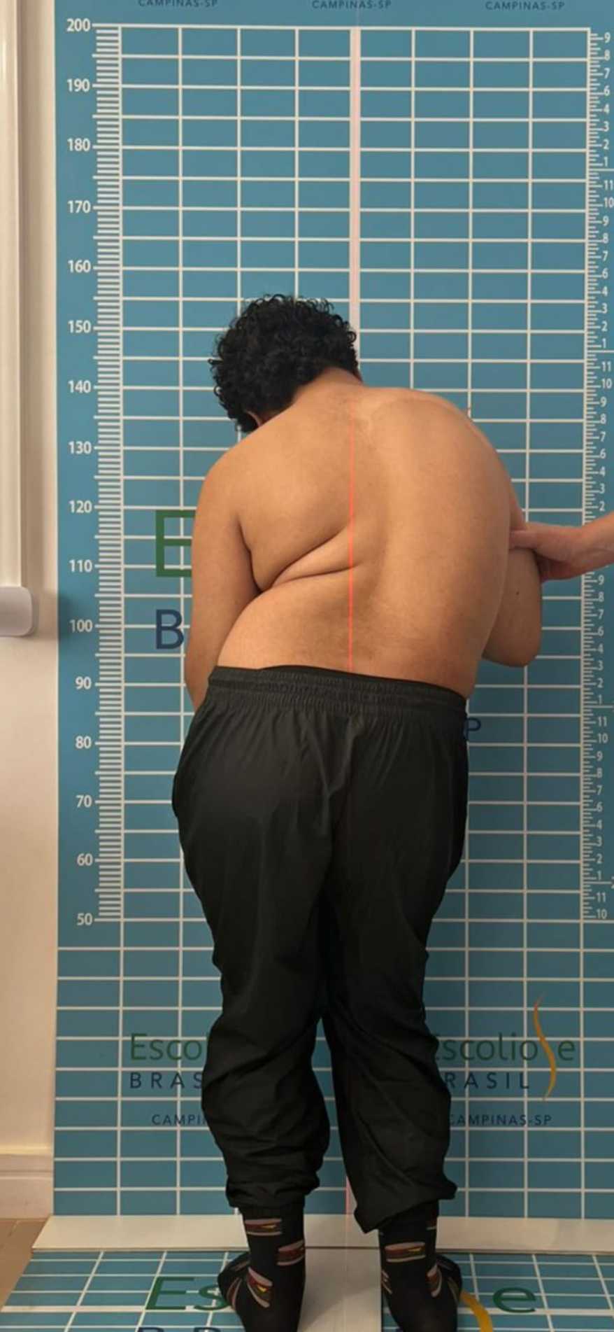 Embora o procedimento seja ofertado pelo Sistema Único de Saúde (SUS), a família relata que o tempo de espera é incompatível com a urgência do caso