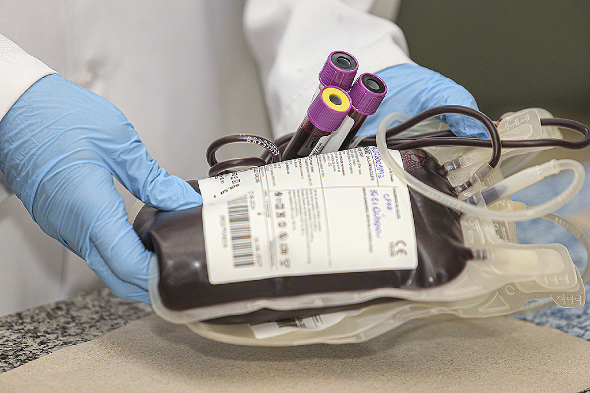 Entre os tipos sanguíneos mais estratégicos estão o O positivo e o O negativo; o primeiro é o mais comum na população, enquanto o segundo é considerado doador universal e amplamente utilizado em situações de emergência
