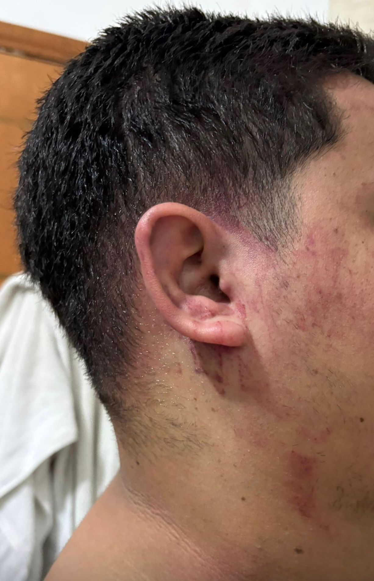 O caso foi registrado como lesão corporal no 1º Distrito Policial de Itapetininga