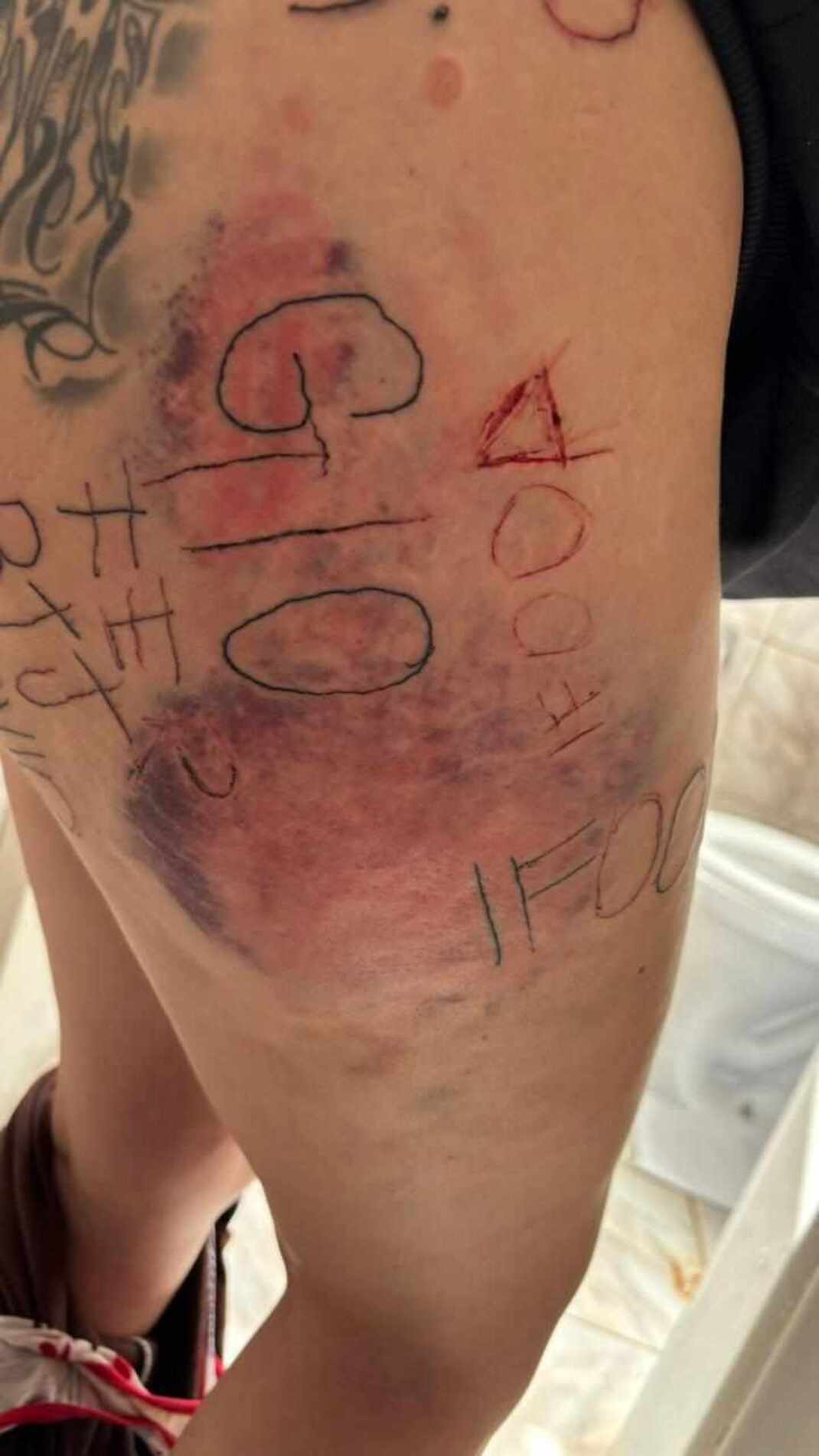 A mulher recebeu atendimento médico e, segundo a polícia, apesar de não haver risco imediato de morte, o estado psicológico é considerado crítico
