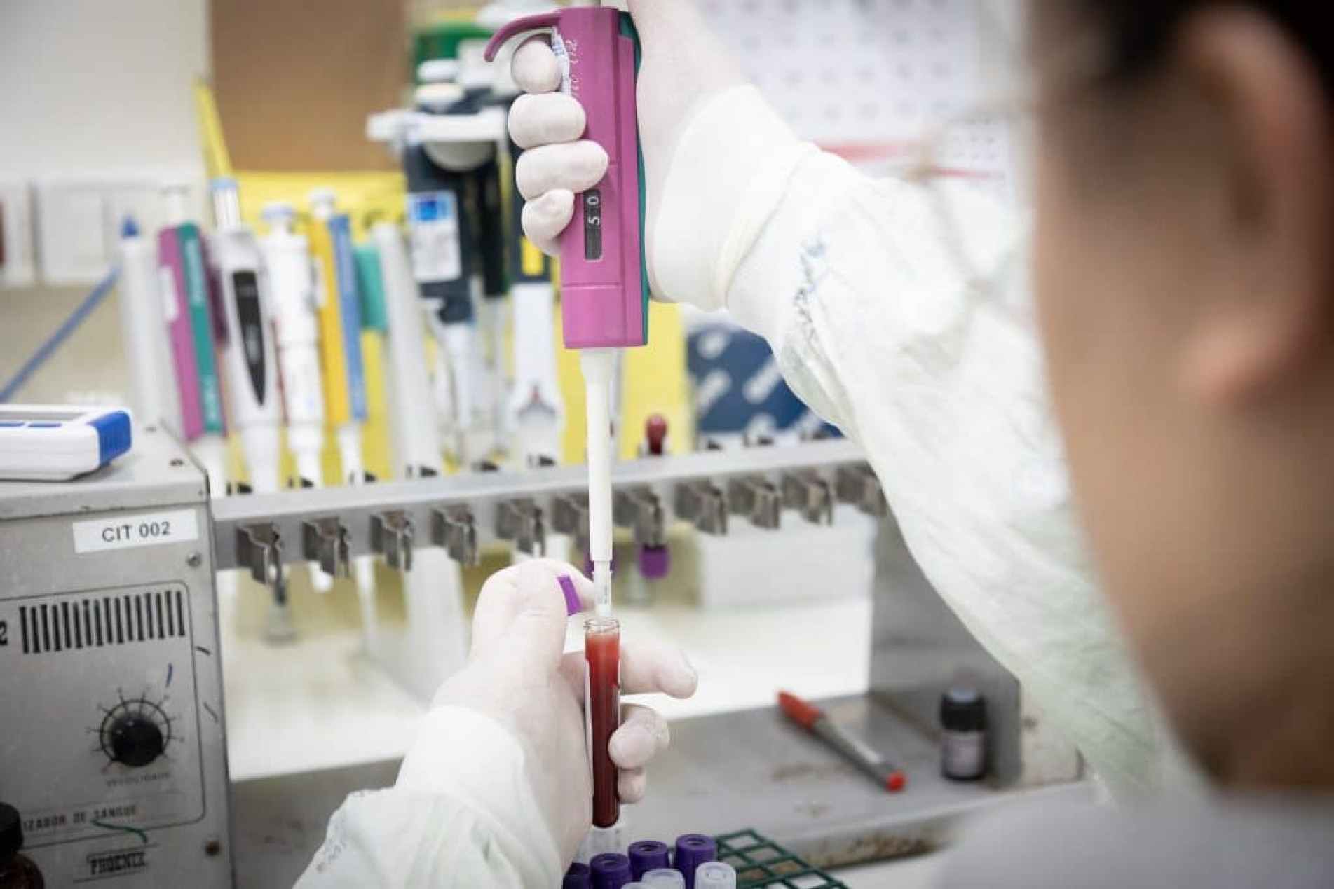 casos suspeitos de ebola devem ser comunicados imediatamente à vigilância epidemiológica municipal e ao CVE-SP