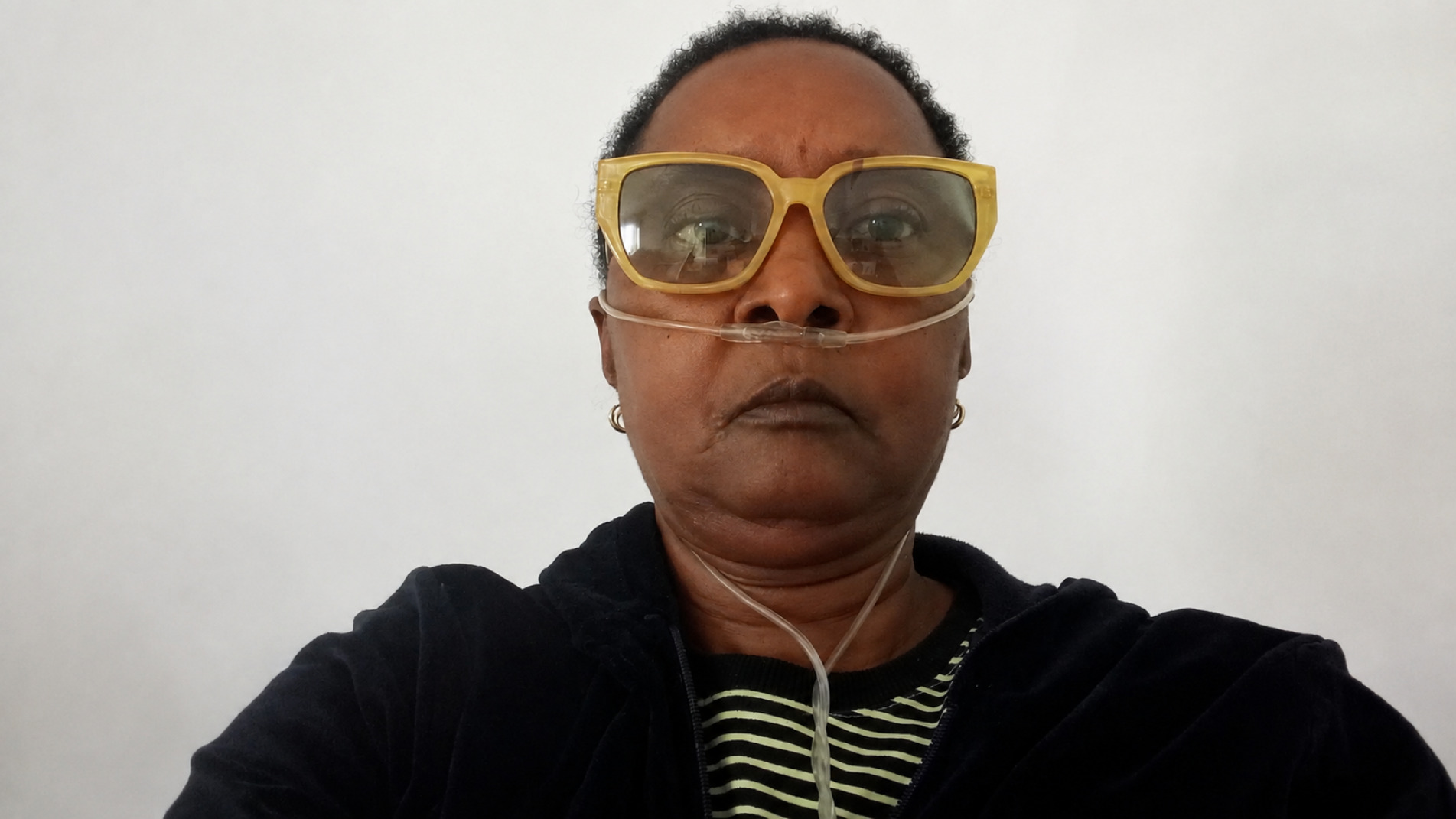 Sandra Maria Oliveira Pinto, 58 anos, portadora da doença fibrose pulmonar idiopática