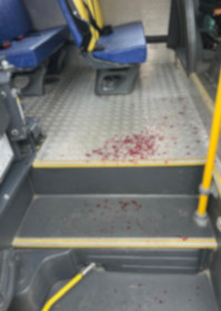 Motorista de transporte escolar é agredido em Mairinque
