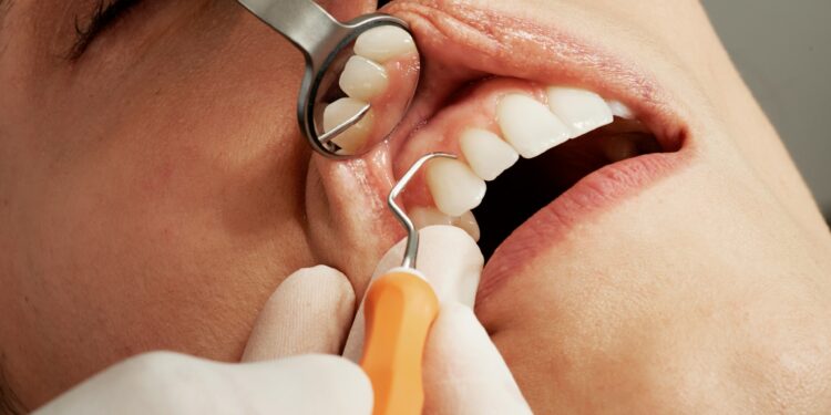 Dentistas estão proibidos de fazer estes procedimentos após decisão da Justiça